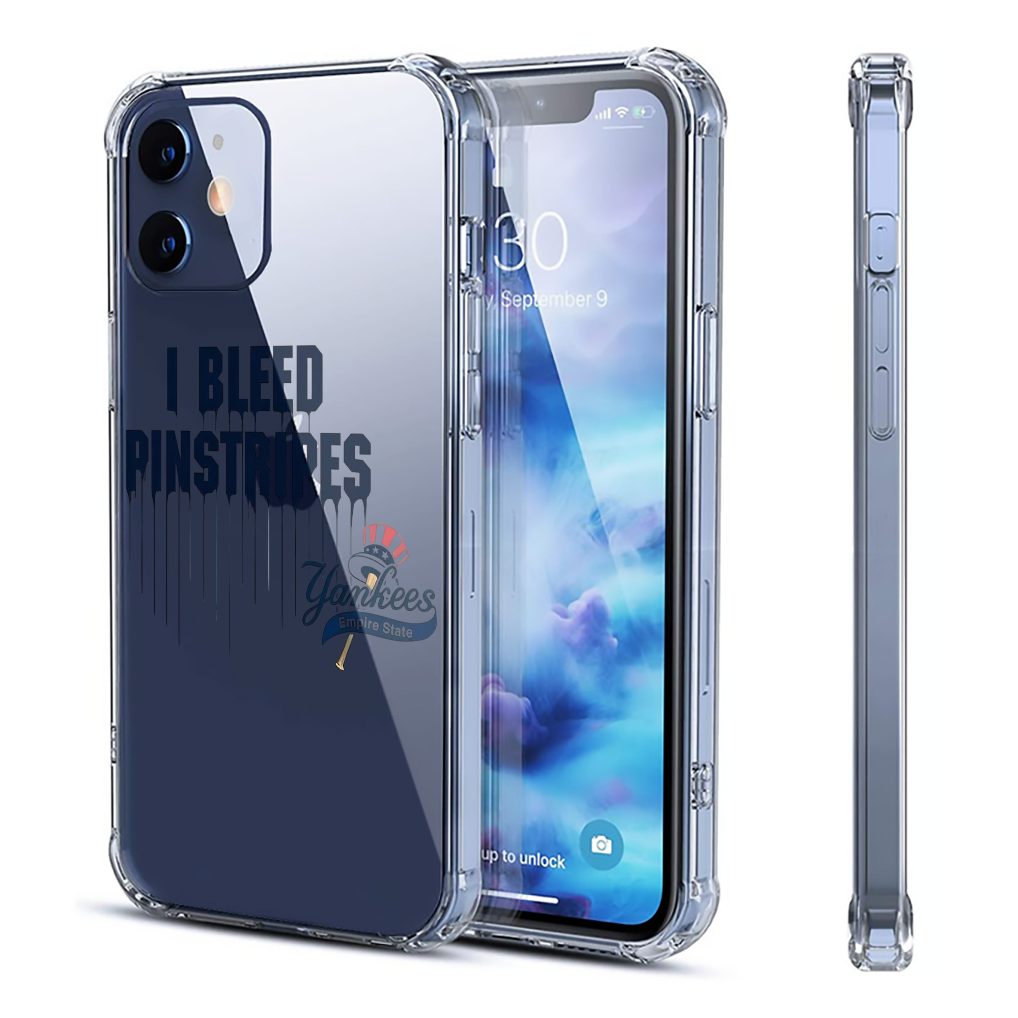 New York Yankees I Bleed Pinstripes Clear IPhone 12 Case – Soft TPU With UV Print – Enhanced Drop Protection, Precise Fit, Anti-Fingerprint, Customizable Design, Scratch-Resistant, Yellow-Resistant